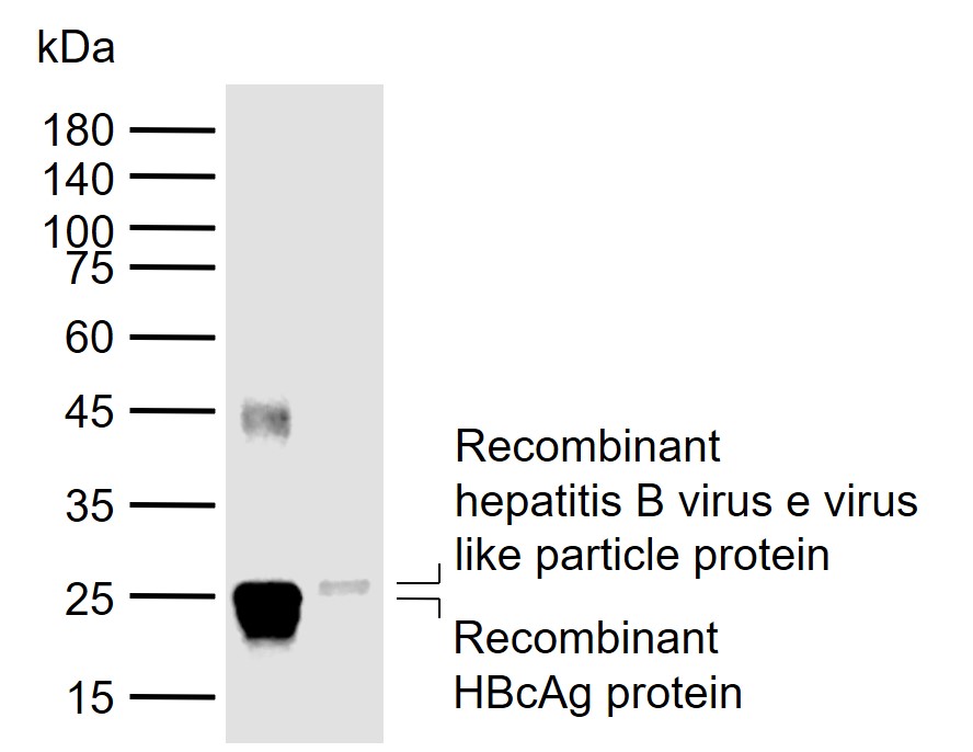 1 - HBeAg Mouse mAb AP94333