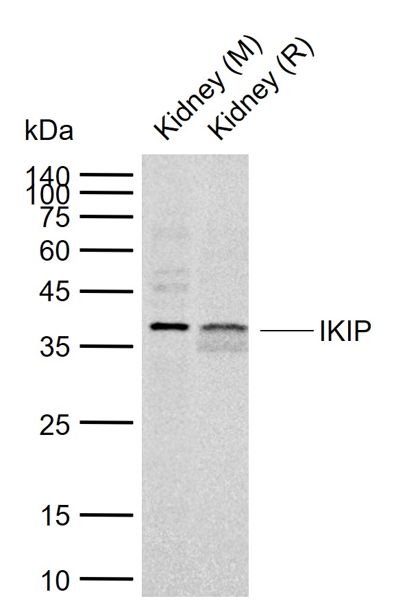 1 - IKIP Rabbit pAb AP94335