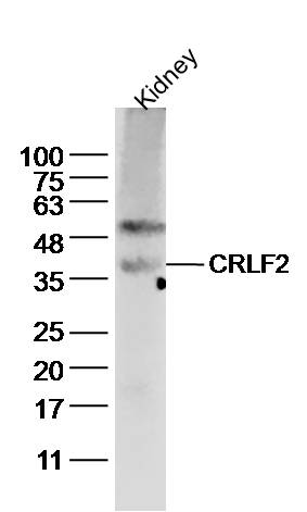 1 - CRLF2 Rabbit pAb AP94337