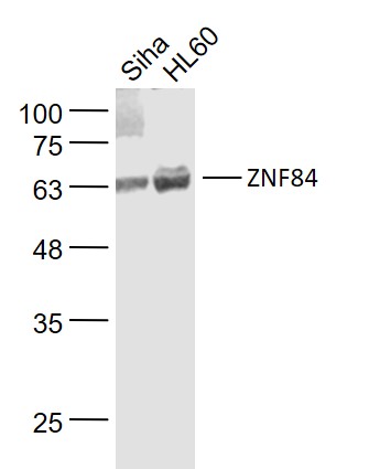 1 - ZNF84 Rabbit pAb AP94339