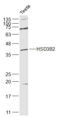 1 - HSD3B2 Rabbit pAb AP94340