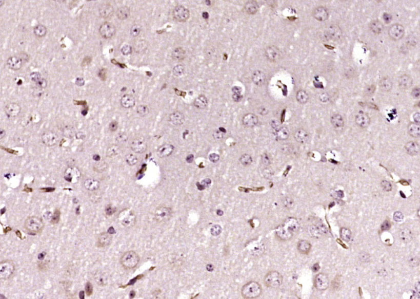 14 - MMS19 Rabbit pAb AP94361