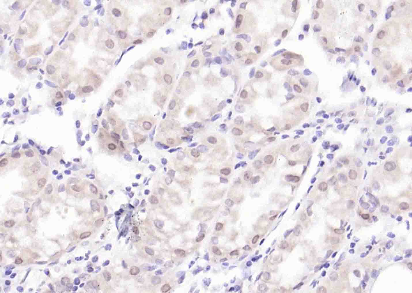 14 - NR1D1 Rabbit pAb AP94362