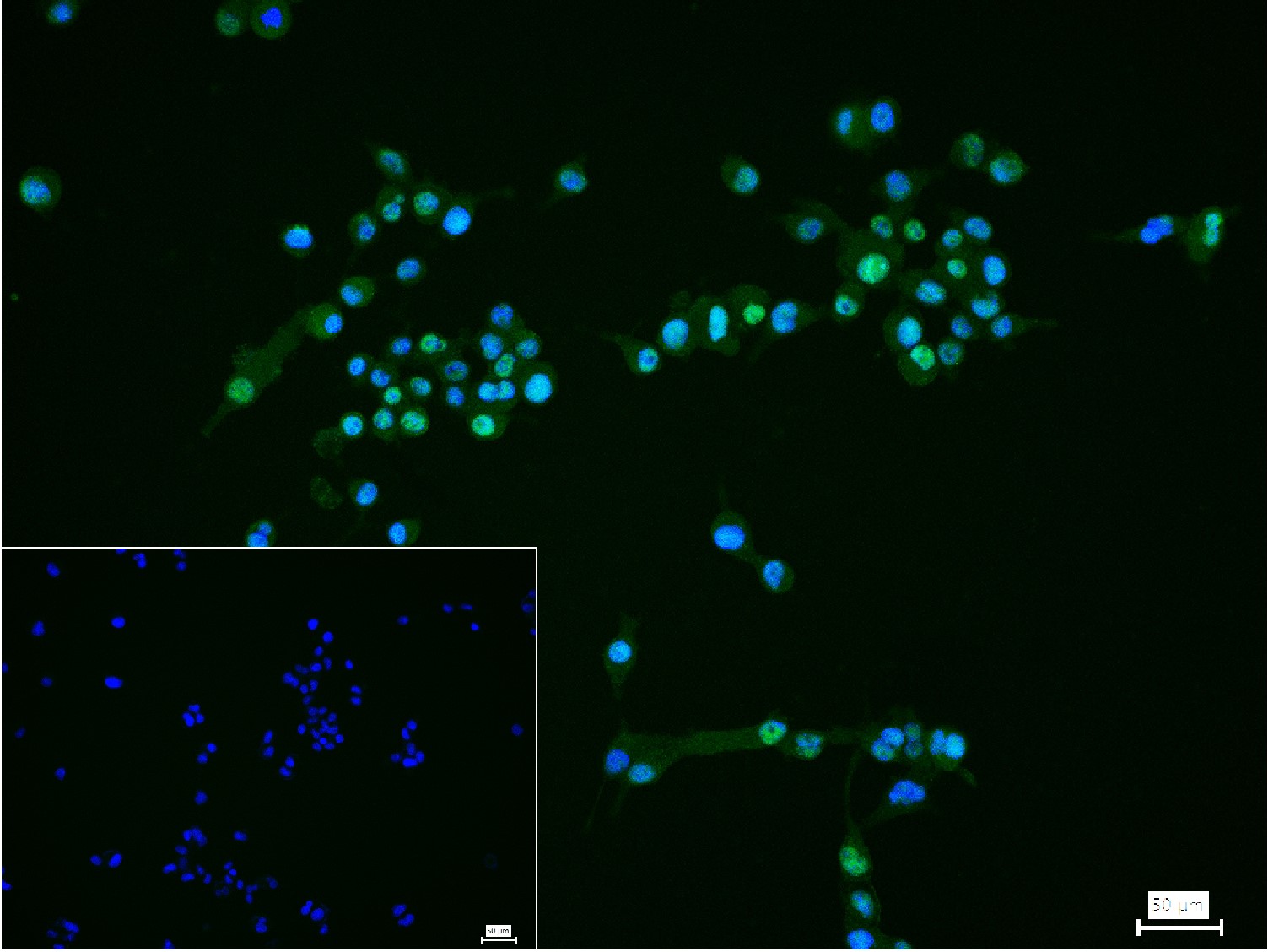 0 - KDM4B Recombinant Rabbit mAb AP94367