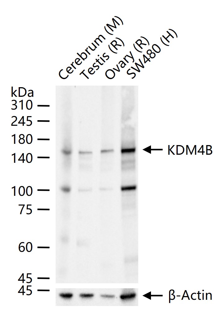 1 - KDM4B Recombinant Rabbit mAb AP94367