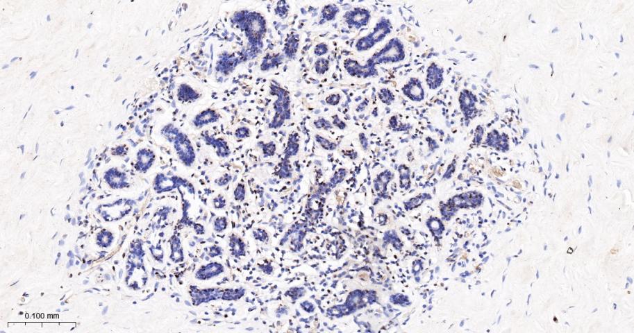 14 - KDM4B Recombinant Rabbit mAb AP94367