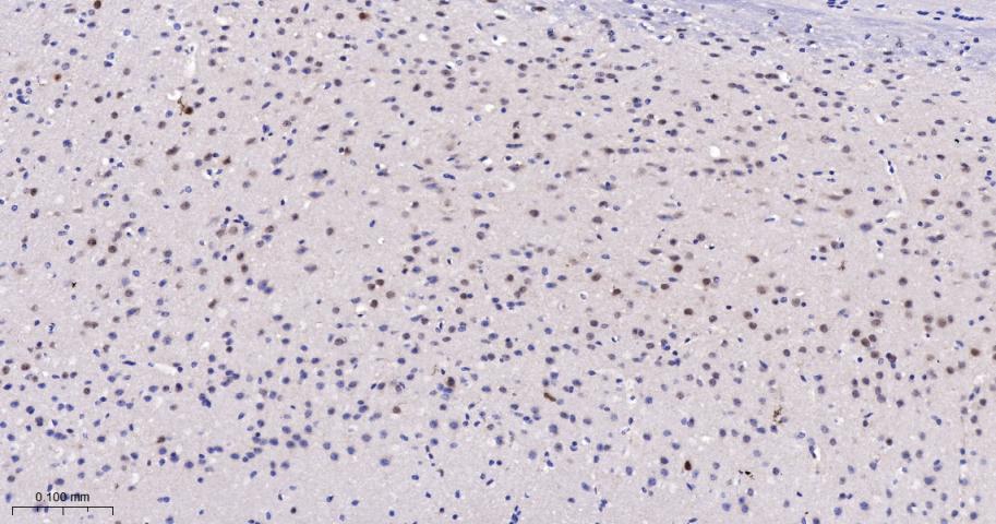 14 - PRMT5 Recombinant Rabbit mAb AP94368