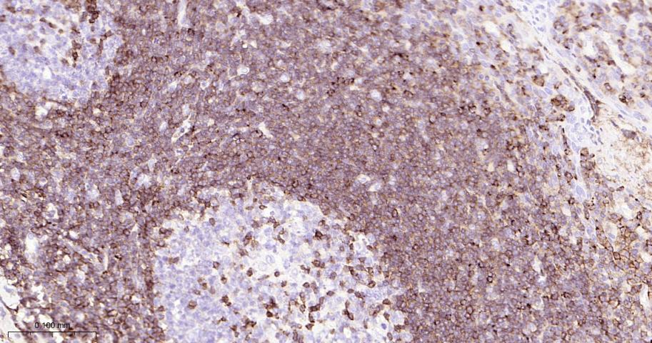 14 - CD50 Recombinant Rabbit mAb AP94369