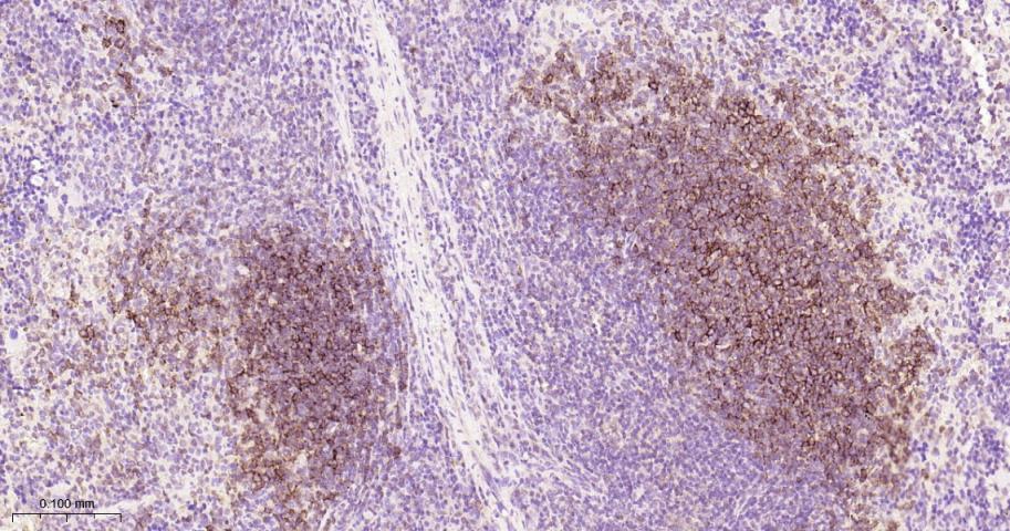 14 - LY75 Recombinant Rabbit mAb AP94374