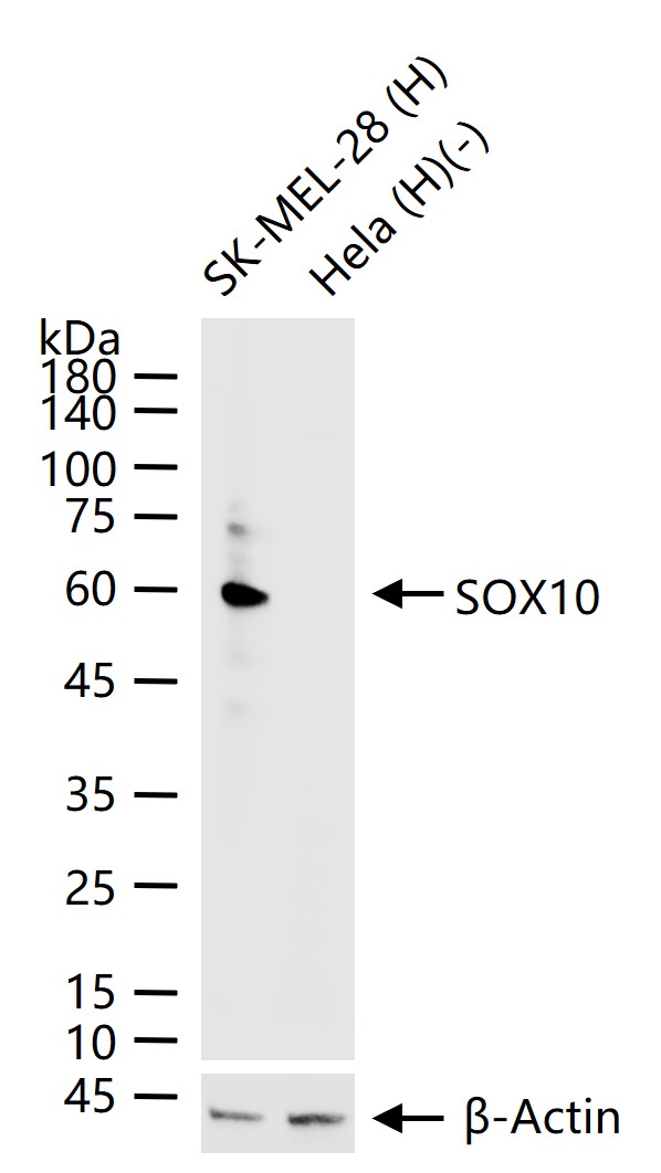 1 - SOX10 Recombinant Rabbit mAb AP94375