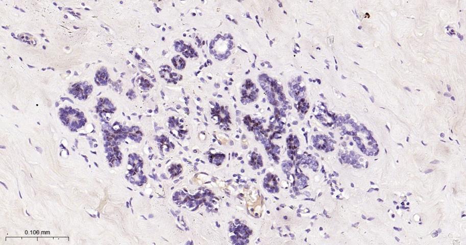 14 - SOX10 Recombinant Rabbit mAb AP94375