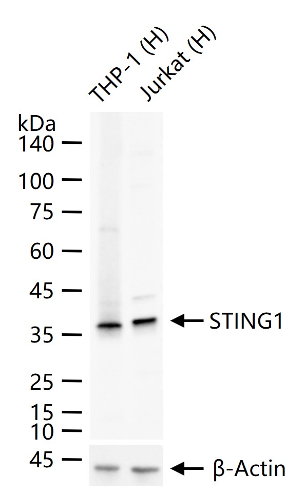 1 - STING1 Recombinant Rabbit mAb AP94378