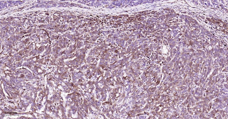 14 - STING1 Recombinant Rabbit mAb AP94378
