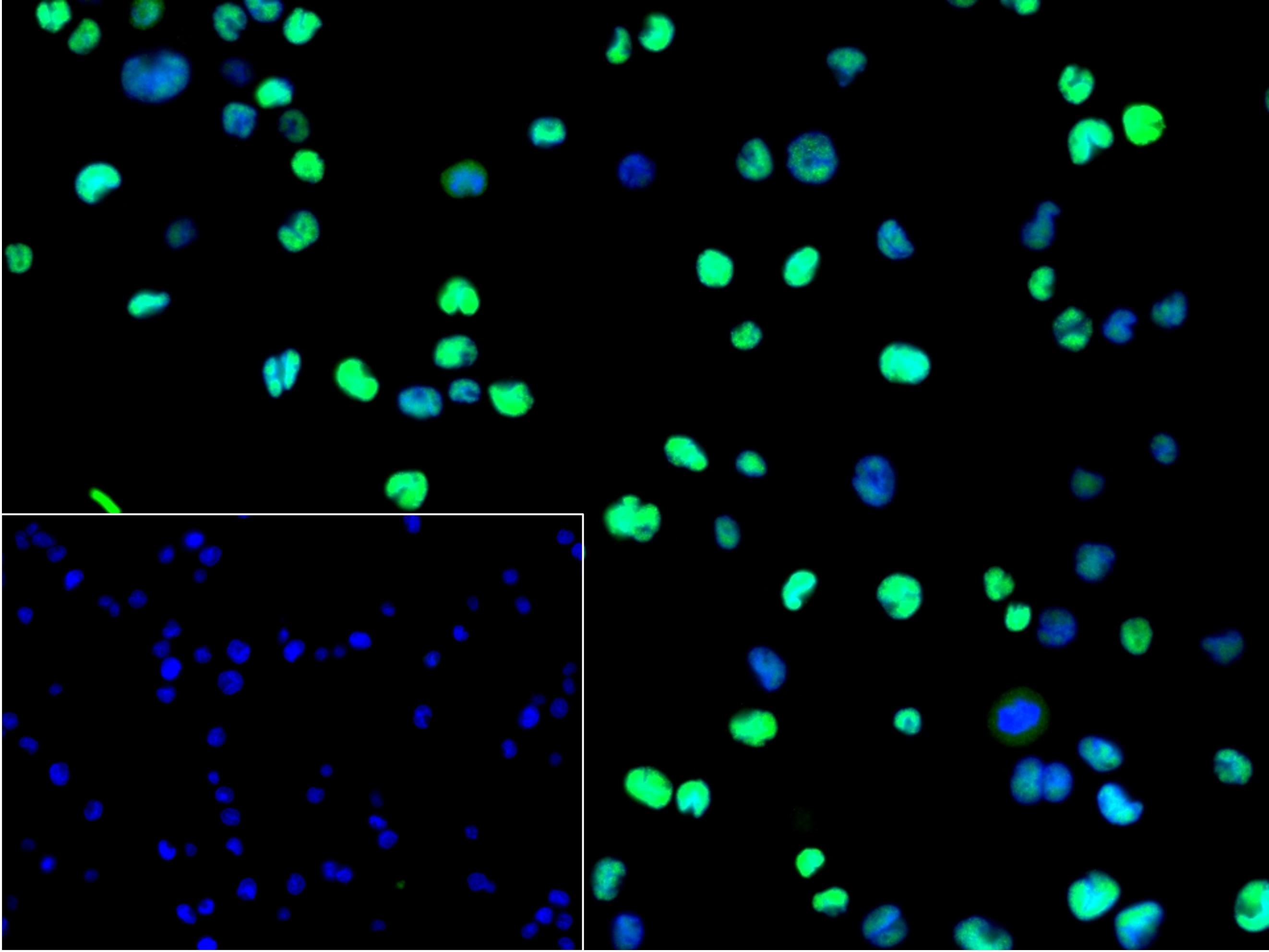 0 - SATB1 Recombinant Rabbit mAb AP94379
