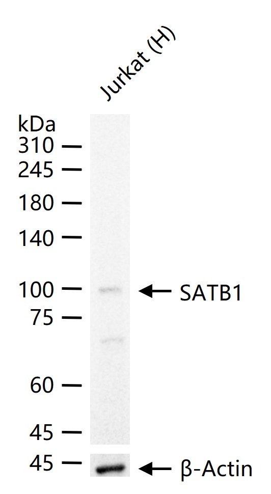 1 - SATB1 Recombinant Rabbit mAb AP94379