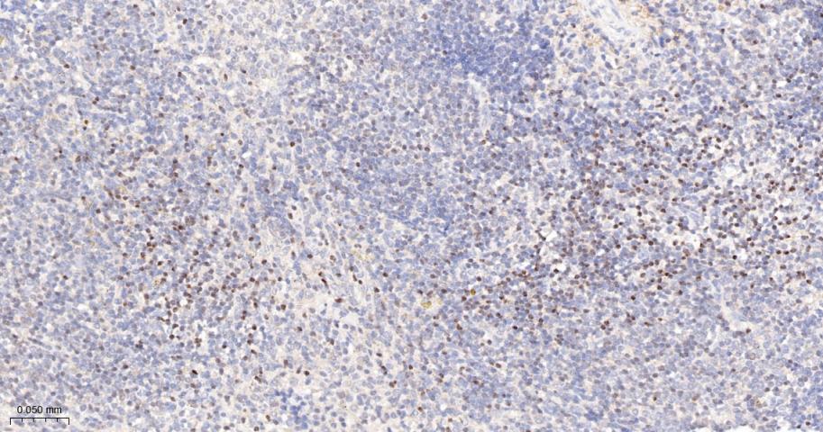 14 - SATB1 Recombinant Rabbit mAb AP94379