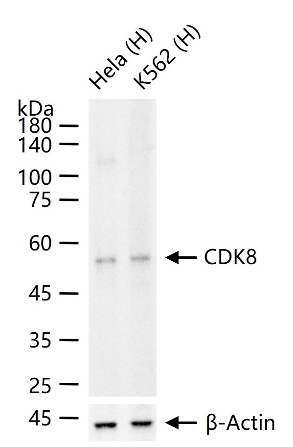 1 - CDK8 Recombinant Rabbit mAb AP94382