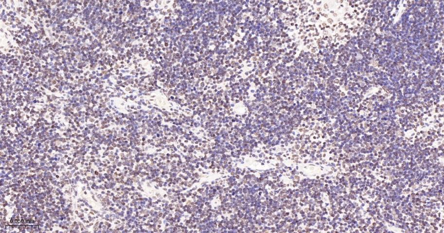 14 - CDK8 Recombinant Rabbit mAb AP94382