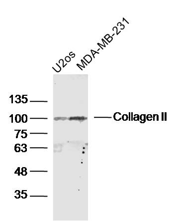 1 - Collagen II Rabbit pAb AP94387