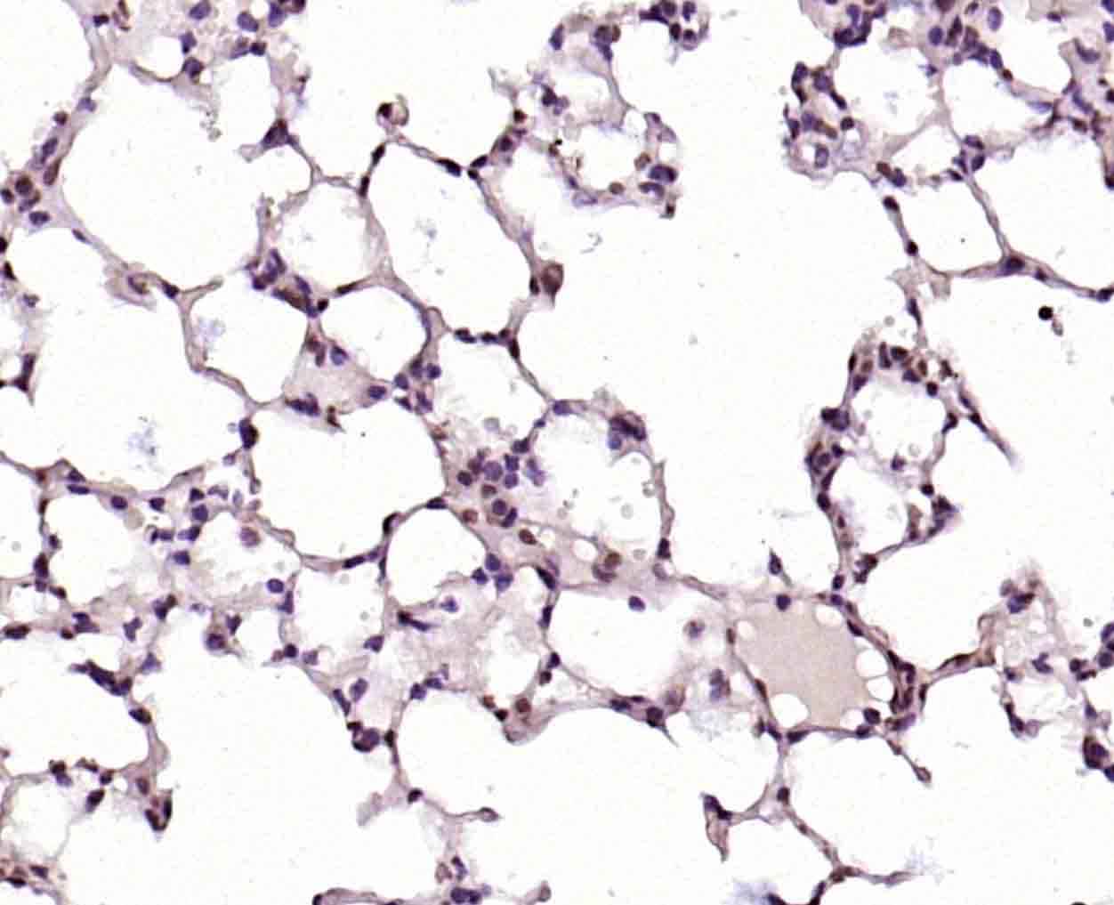 14 - CLK2 Rabbit pAb AP94390