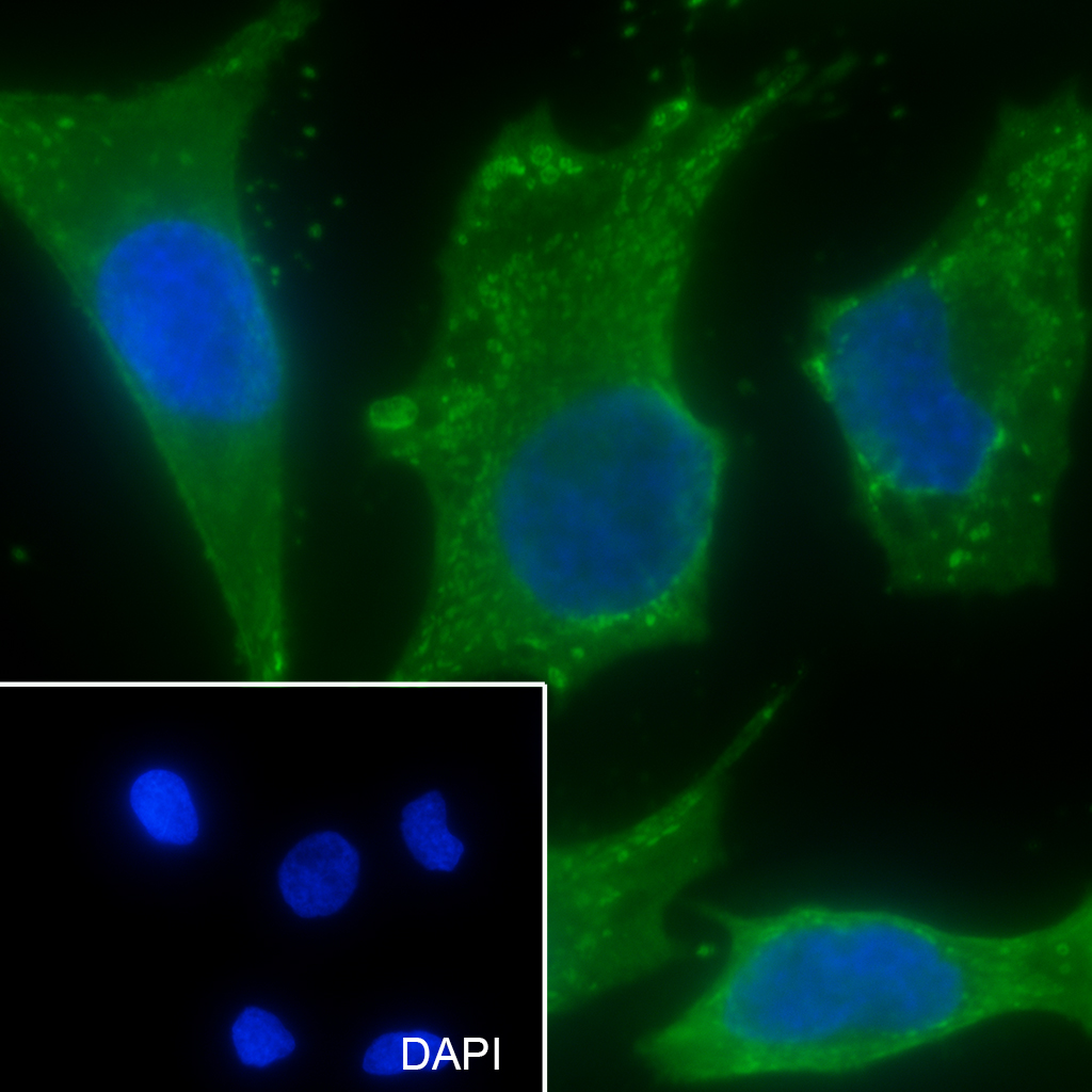 0 - CAPG Recombinant Mouse mAb AP94396