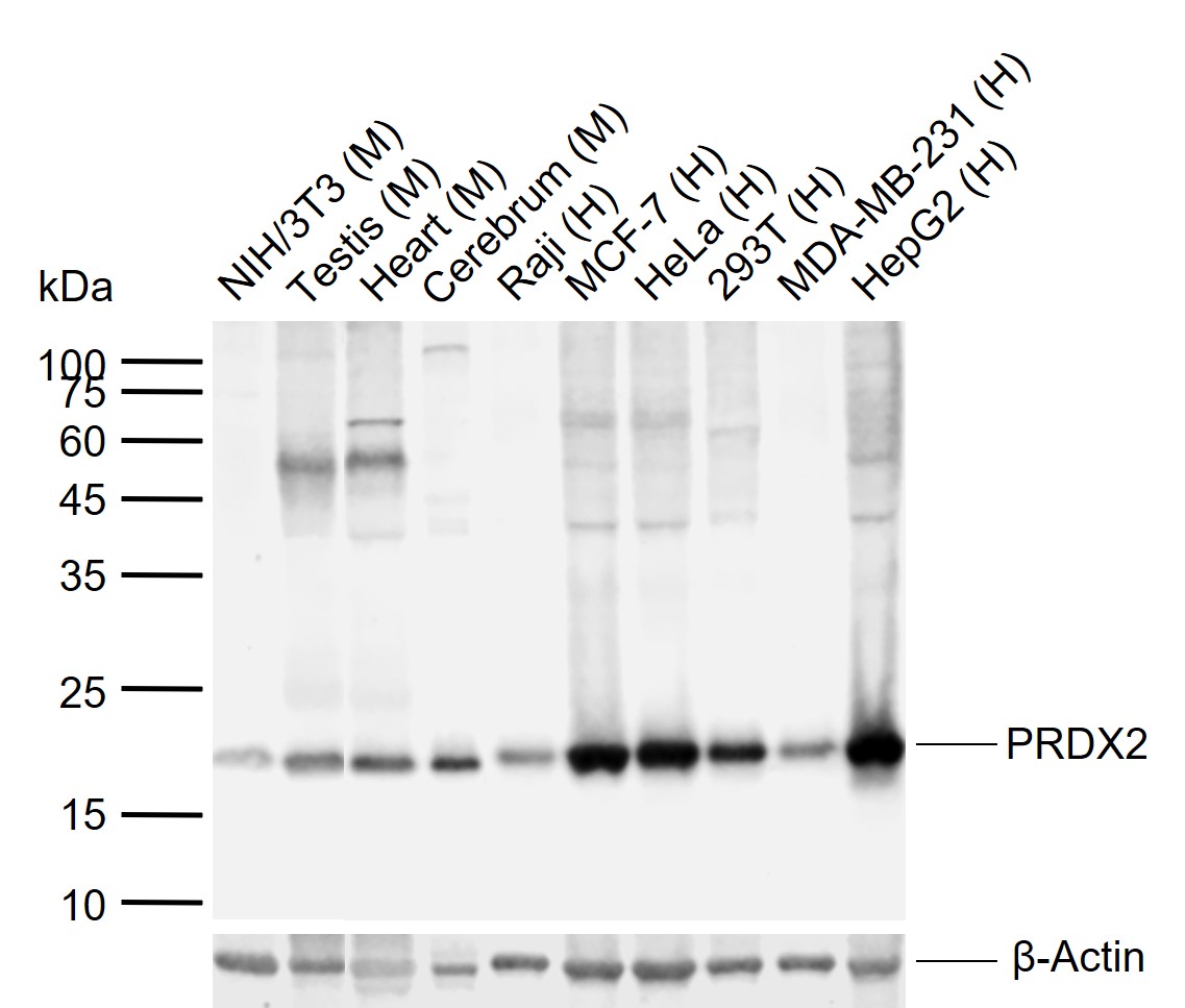 1 - PRDX2 Recombinant Mouse mAb AP94399