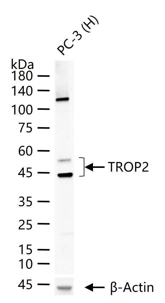 1 - TROP2 Recombinant Rabbit mAb AP94410