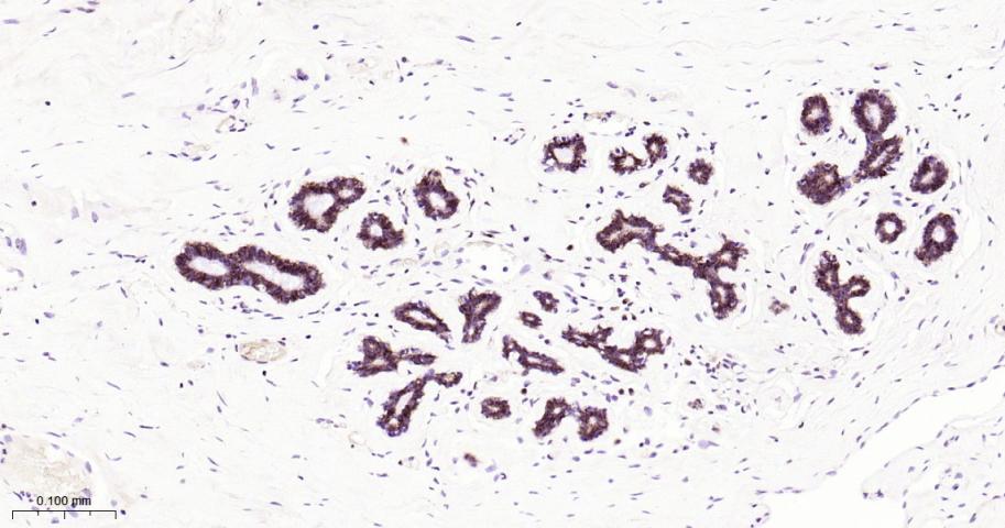 14 - TROP2 Recombinant Rabbit mAb AP94410