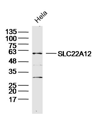 1 - SLC22A12 Rabbit pAb AP94412