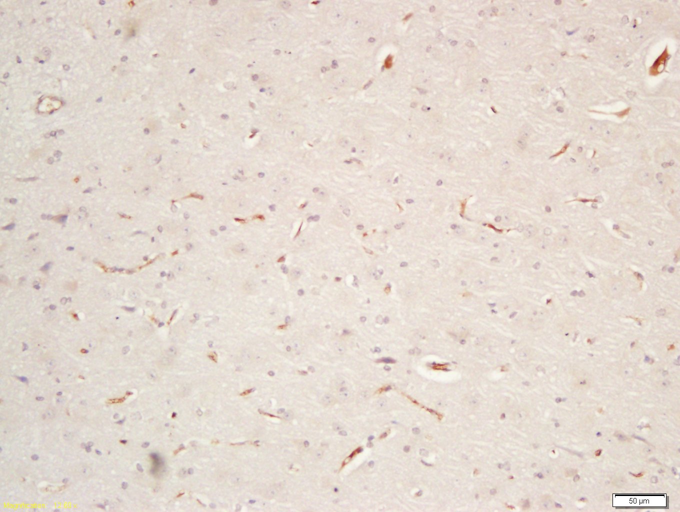 14 - CNTF Rabbit pAb AP94413