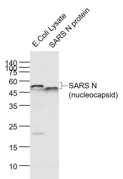 1 - SARS-CoV Nucleocapsid Mouse mAb AP94416