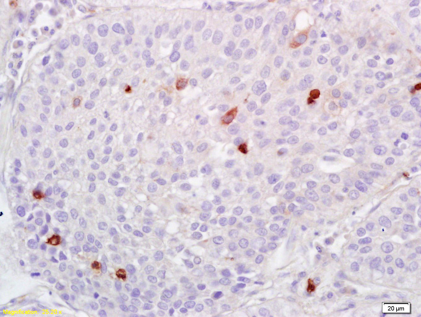 14 - ADAMTS1 Rabbit pAb AP94418