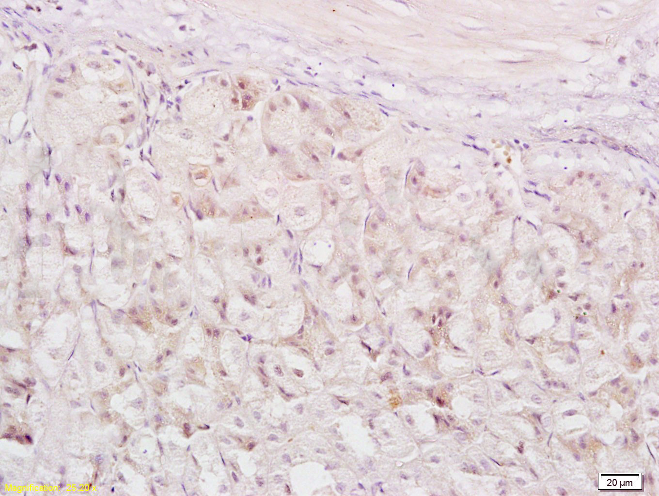 14 - XAF1 Rabbit pAb AP94420