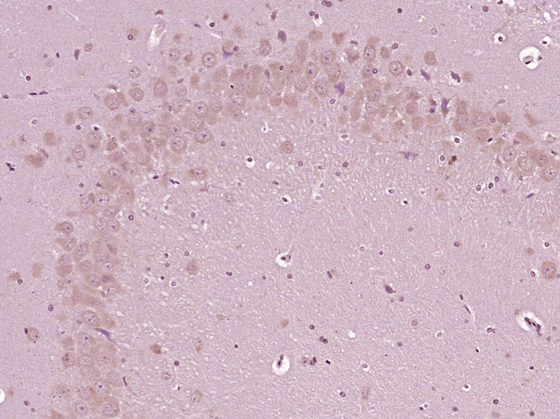14 - phospho-AMPK beta 1 (Ser108) Rabbit pAb AP94422