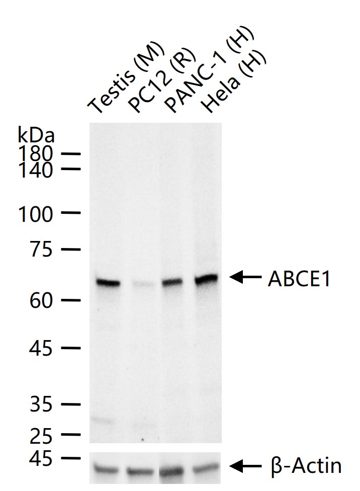 1 - ABCE1 Recombinant Rabbit mAb AP94423
