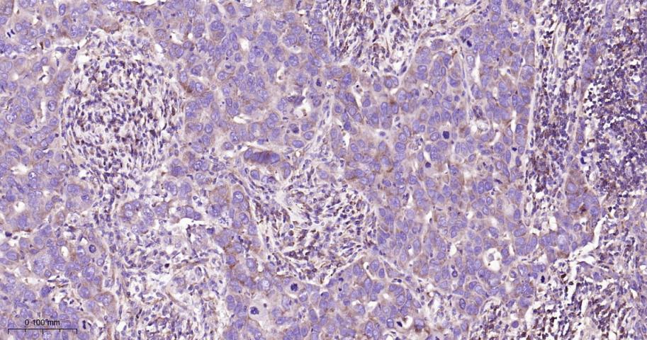 14 - ABCE1 Recombinant Rabbit mAb AP94423