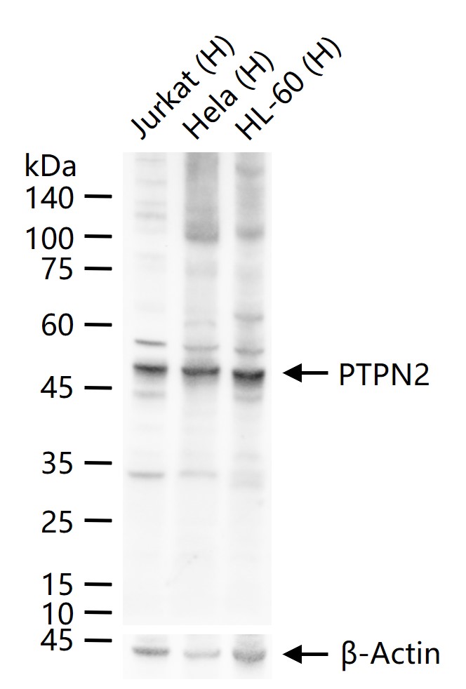 1 - PTPN2 Recombinant Mouse mAb AP94433