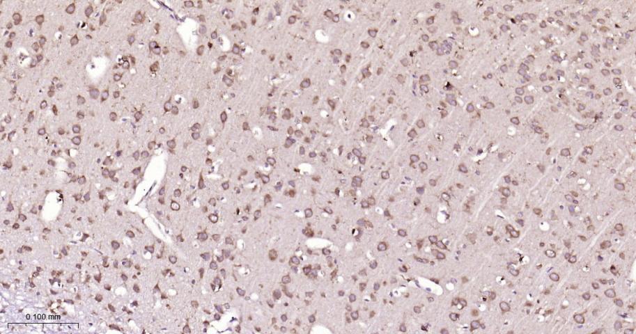 14 - PTPN2 Recombinant Mouse mAb AP94433