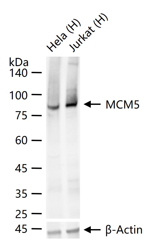 1 - MCM5 Recombinant Rabbit mAb AP94436