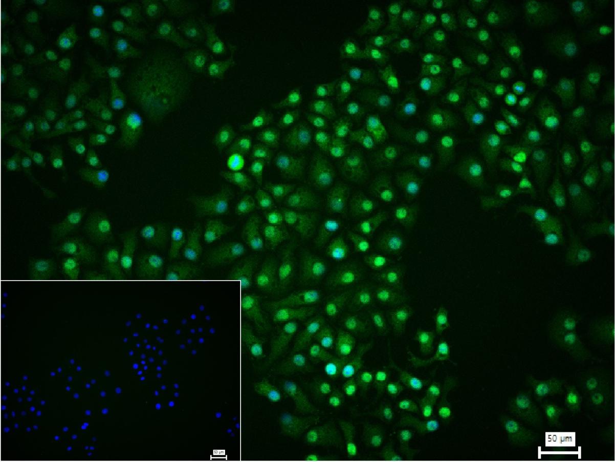 0 - PSMA1 Recombinant Rabbit mAb AP94437