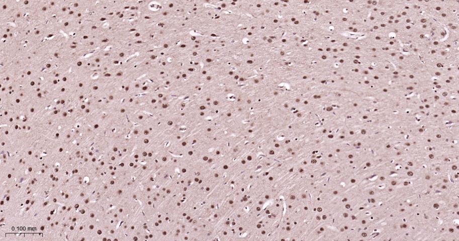 14 - PSMA1 Recombinant Rabbit mAb AP94437