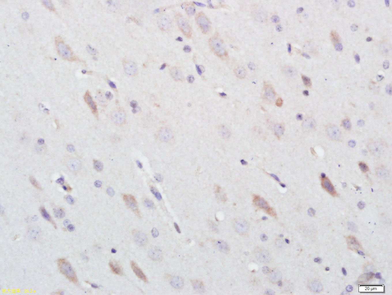 14 - 3-Nitrotyrosine Rabbit pAb AP94442