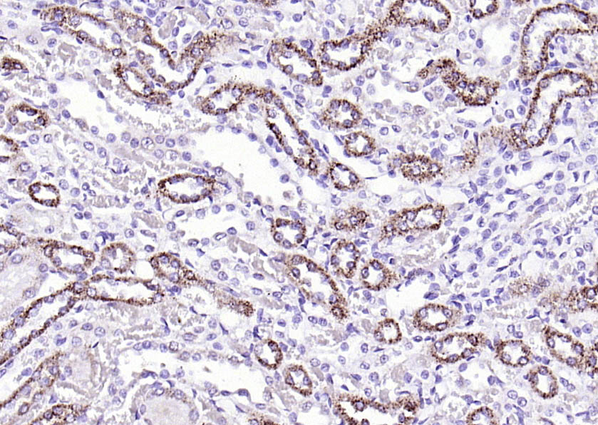 14 - liver FABP Rabbit pAb AP94444