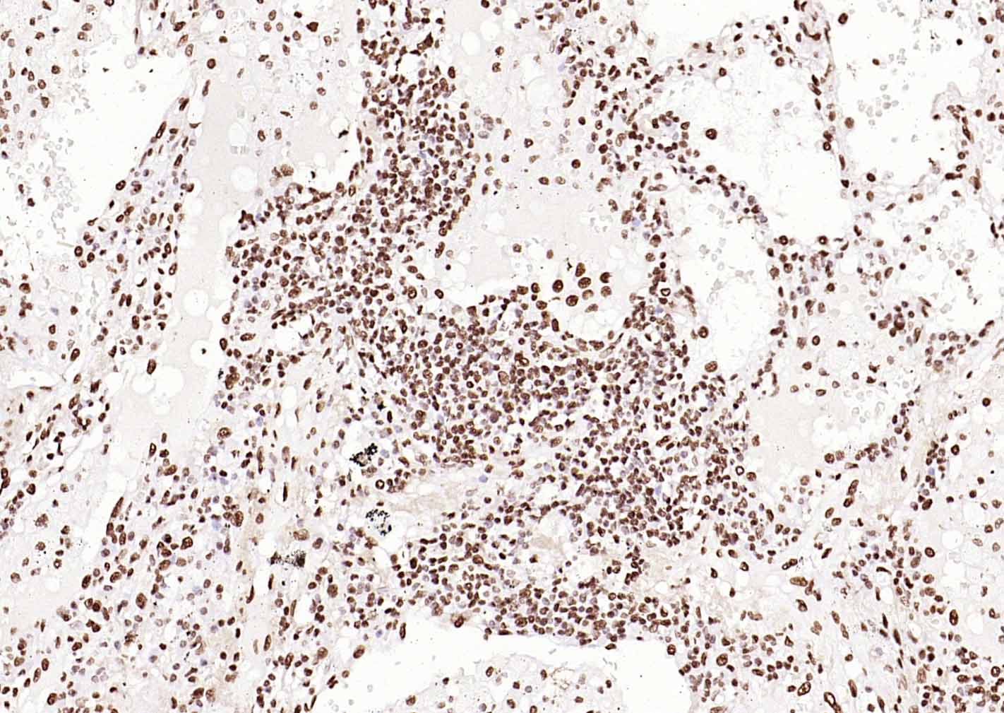 14 - ERCC1 Recombinant Rabbit mAb AP94451