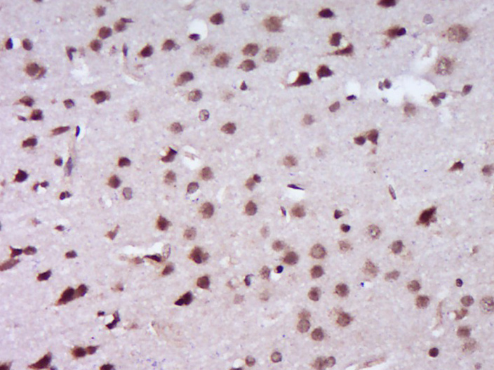 14 - BRCA1 Rabbit pAb AP94454