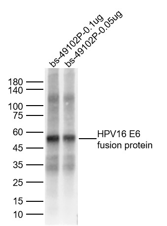 1 - HPV16 E6 Rabbit pAb AP94472