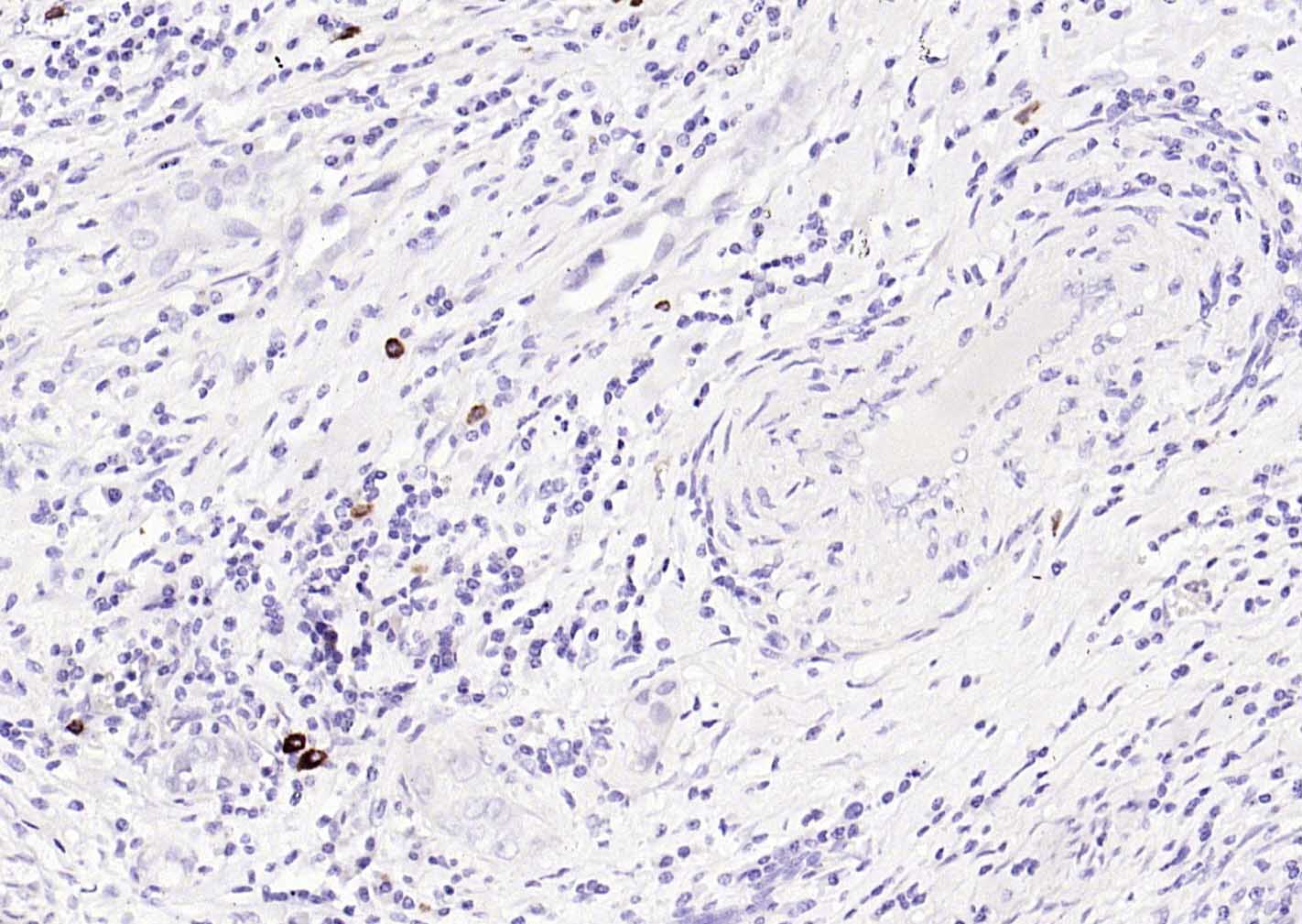 14 - HPV16 E6 Rabbit pAb AP94472