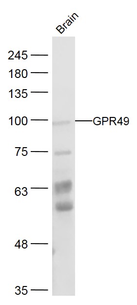 1 - GPR49 Rabbit pAb AP94473