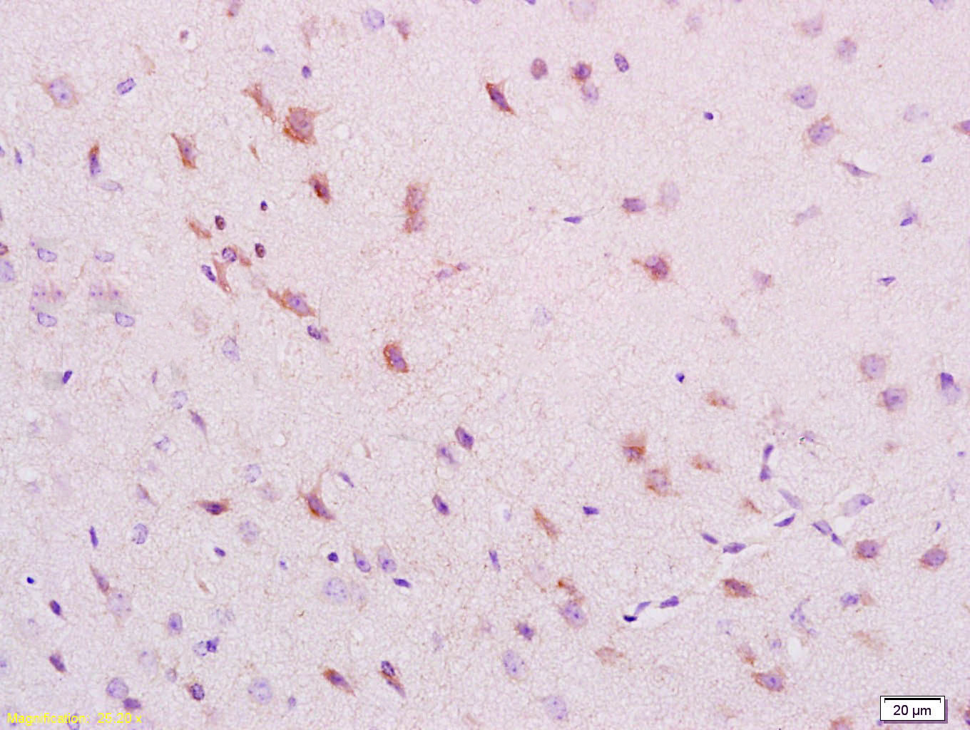 14 - phospho-NRP1 (Thr916) Rabbit pAb AP94476