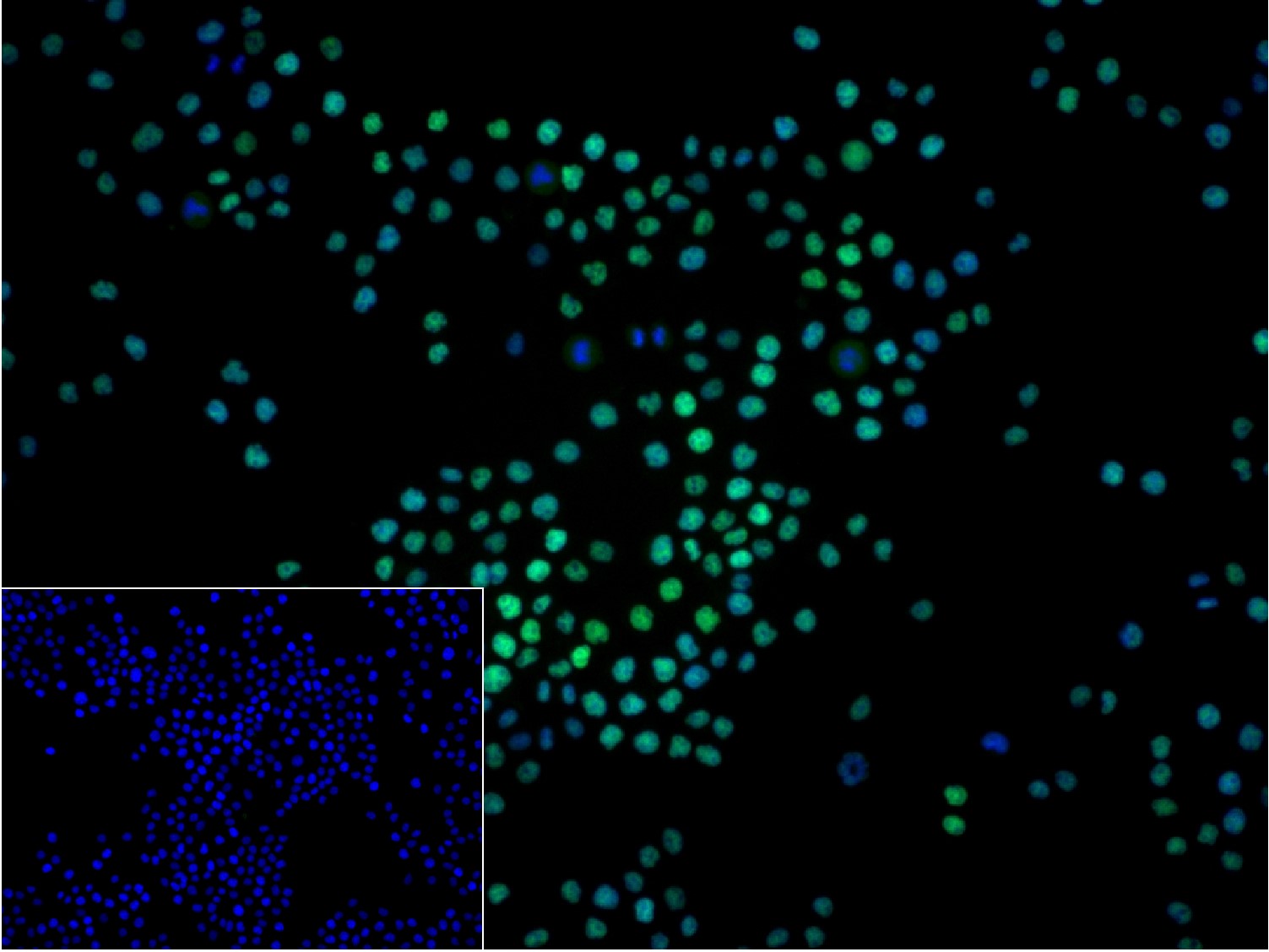 0 - RBBP4 Recombinant Rabbit mAb AP94487